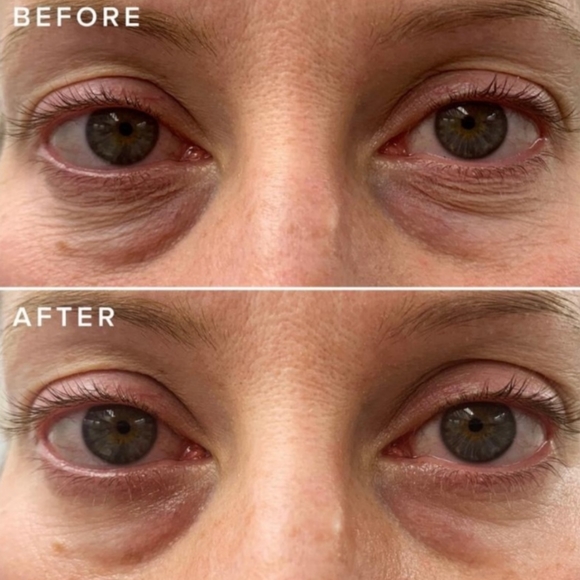 Farmacy | Cheer Up Brightening Vitamin C Eye Cream - Picture 5 of 16